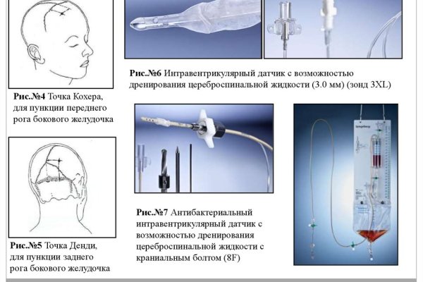 Дарк нет кракен